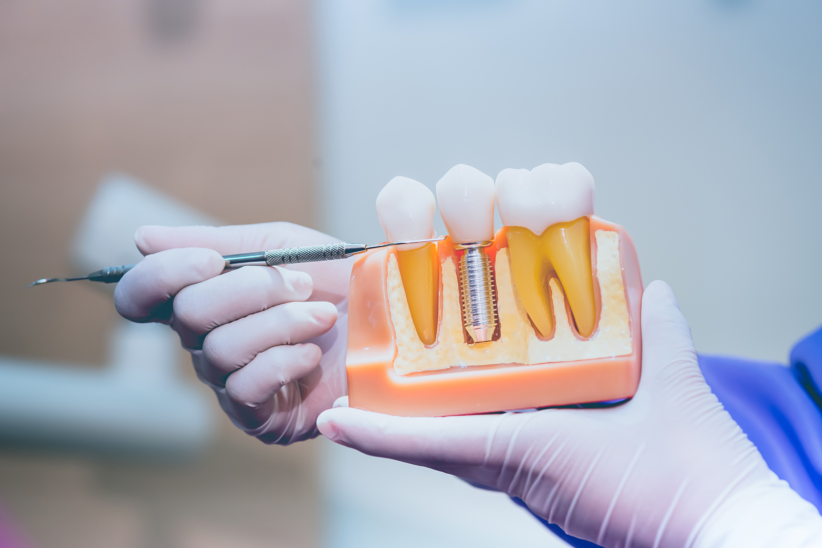 General and Implant Dentistry | Fluoride Treatment, Oral Cancer Screening and Inlays amp Onlays