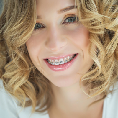 A woman with braces is smiling at the camera.