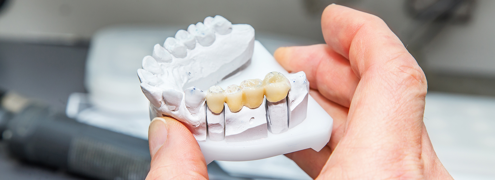 The image shows a person s hand holding a toothbrush with bristles, where the bristles are shaped like teeth.