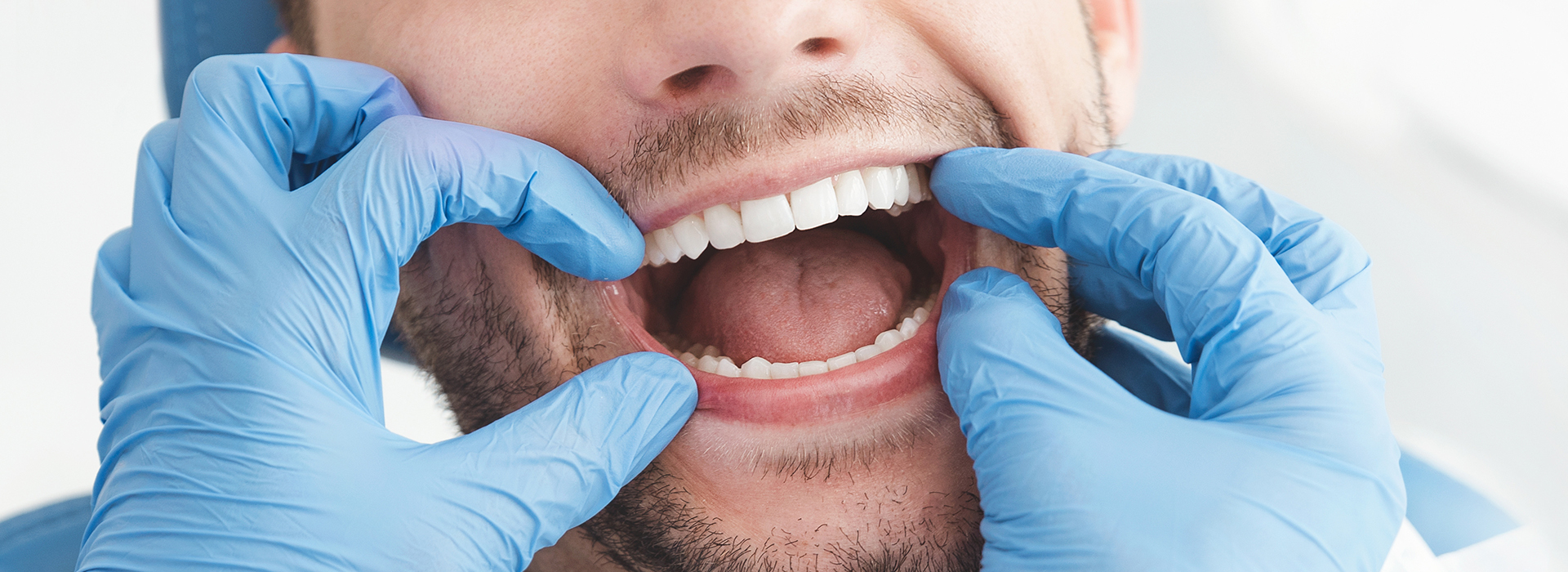 A man in a dental office, wearing blue gloves and a white mask, is holding his mouth open with both hands while sitting in the chair.