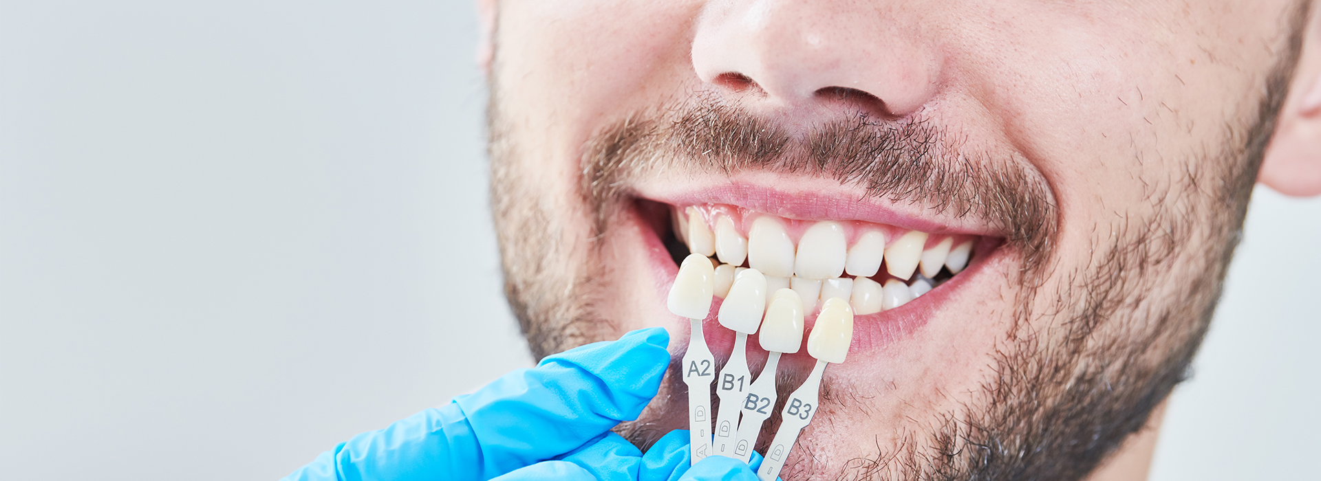 The image shows a person with a toothy smile, wearing a blue surgical mask and holding dental implants.