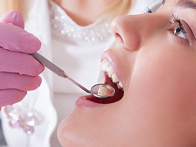 A dental professional is performing a teeth cleaning procedure on a patient s mouth using specialized tools.